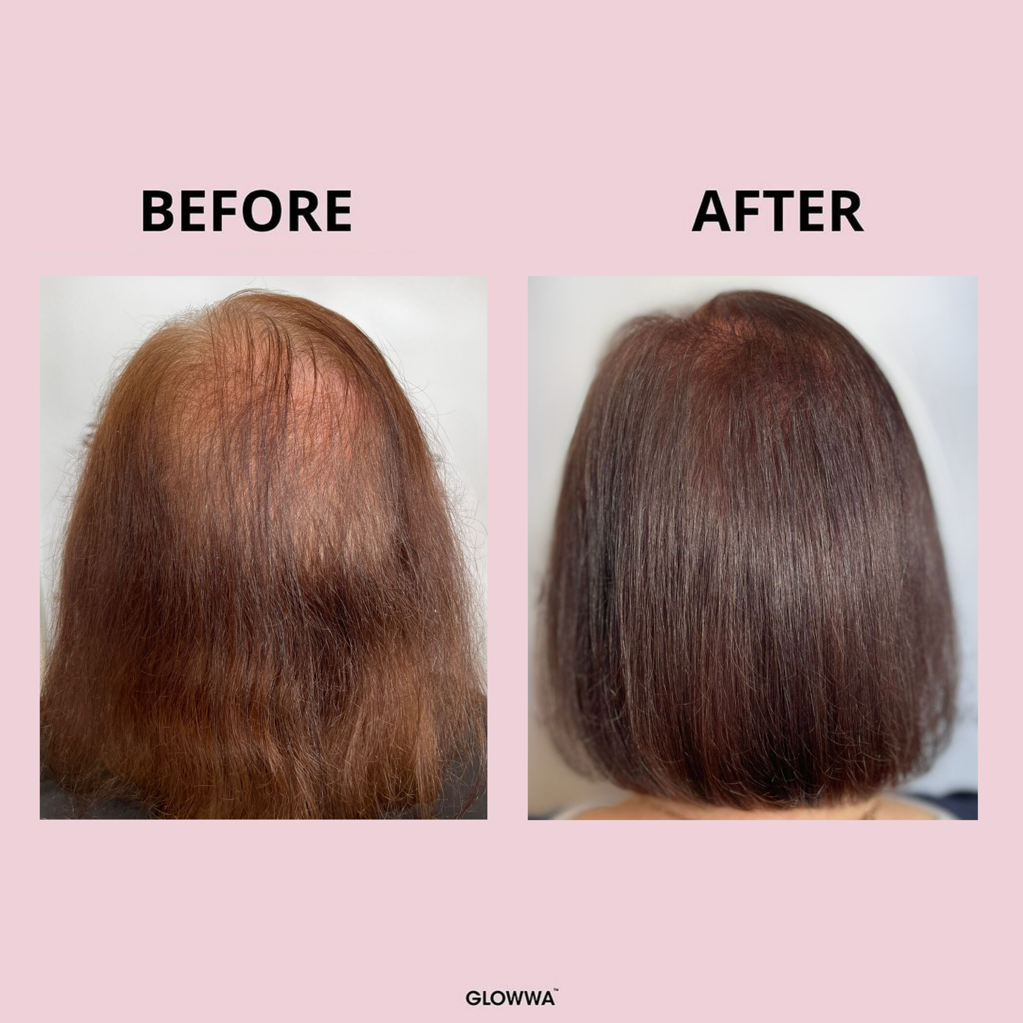 GLOWWA™ Results driven hair nutrition