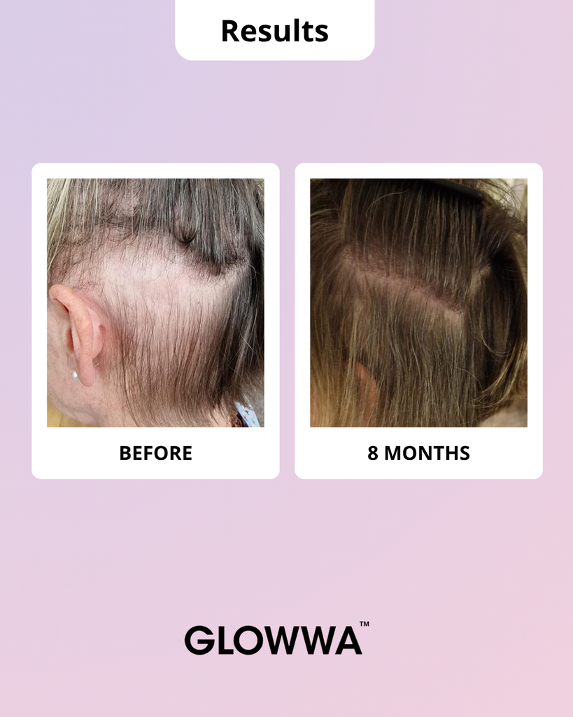 HAIR FOOD | MENO - 1 Month Supply