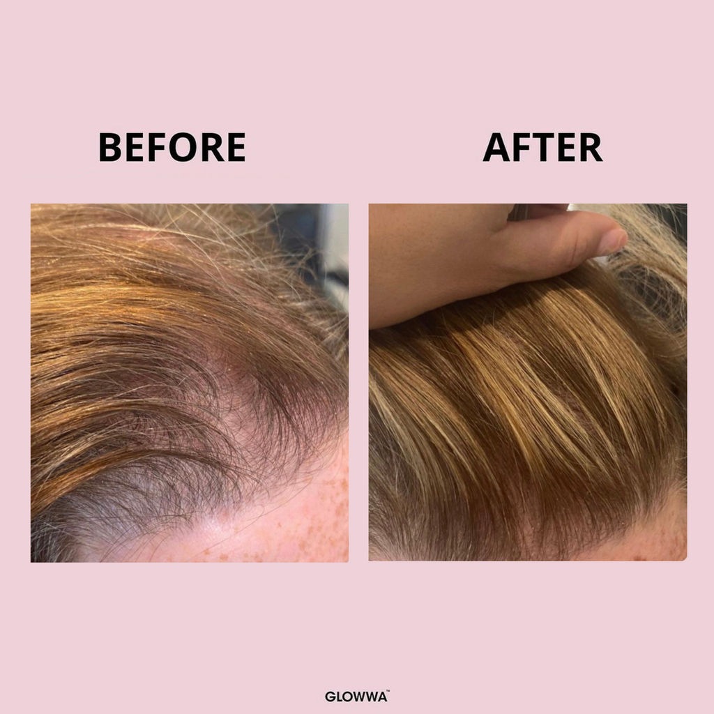 HAIR GUMMY VITAMINS – Hair Fetish Studio The Collection