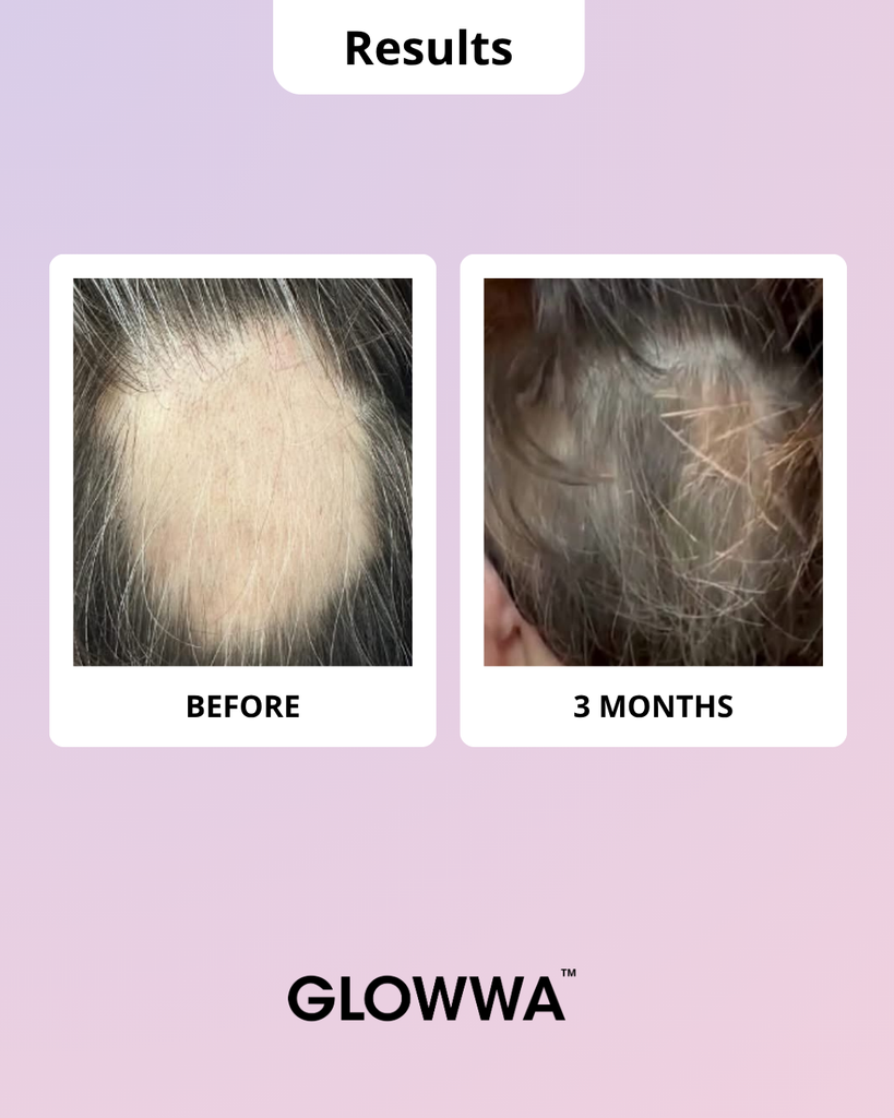 HAIR FOOD | MENO - 1 Month Supply