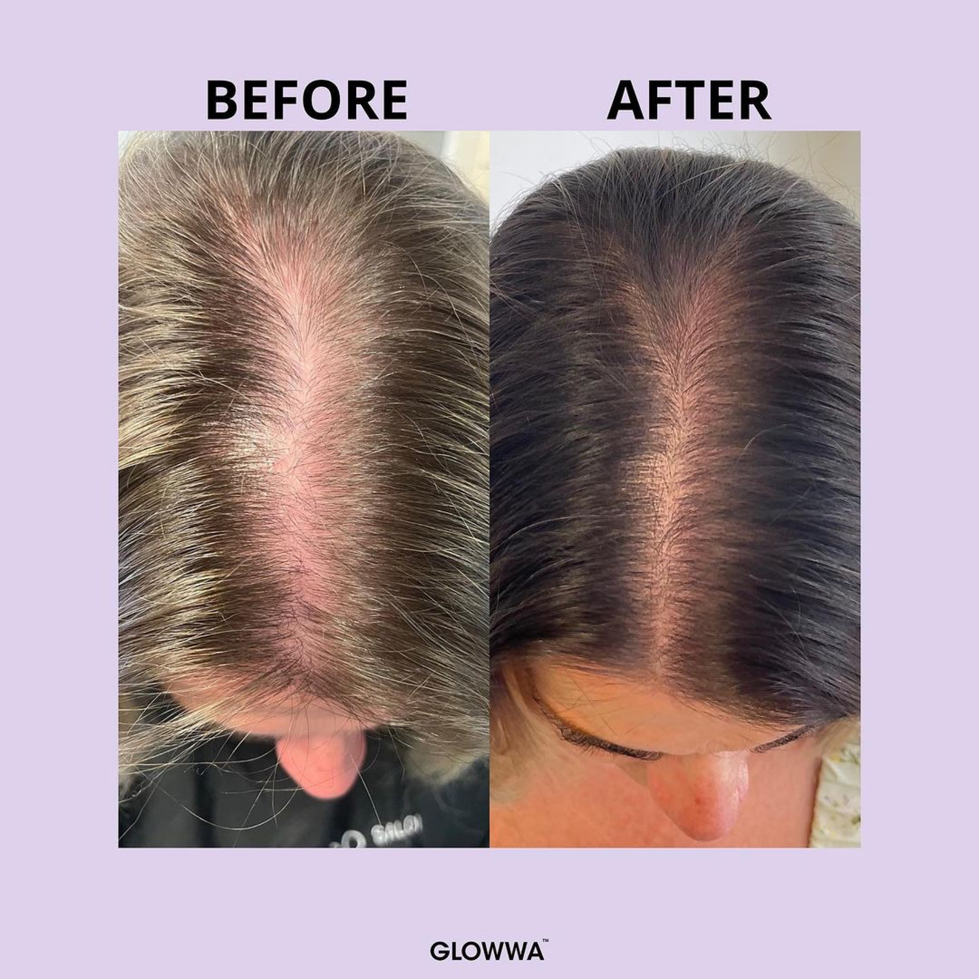 HAIR FOOD MENO 1 Month Supply GLOWWA
