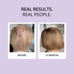 HAIR FOOD | MENO - 1 Month Supply