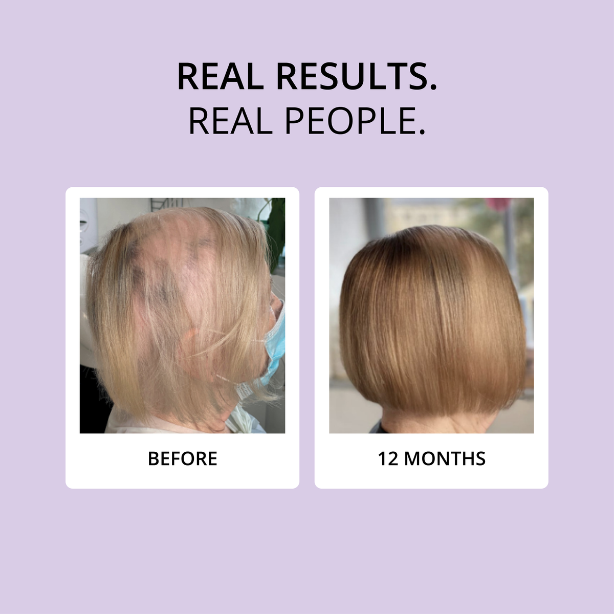 HAIR FOOD | MENO - 1 Month Supply