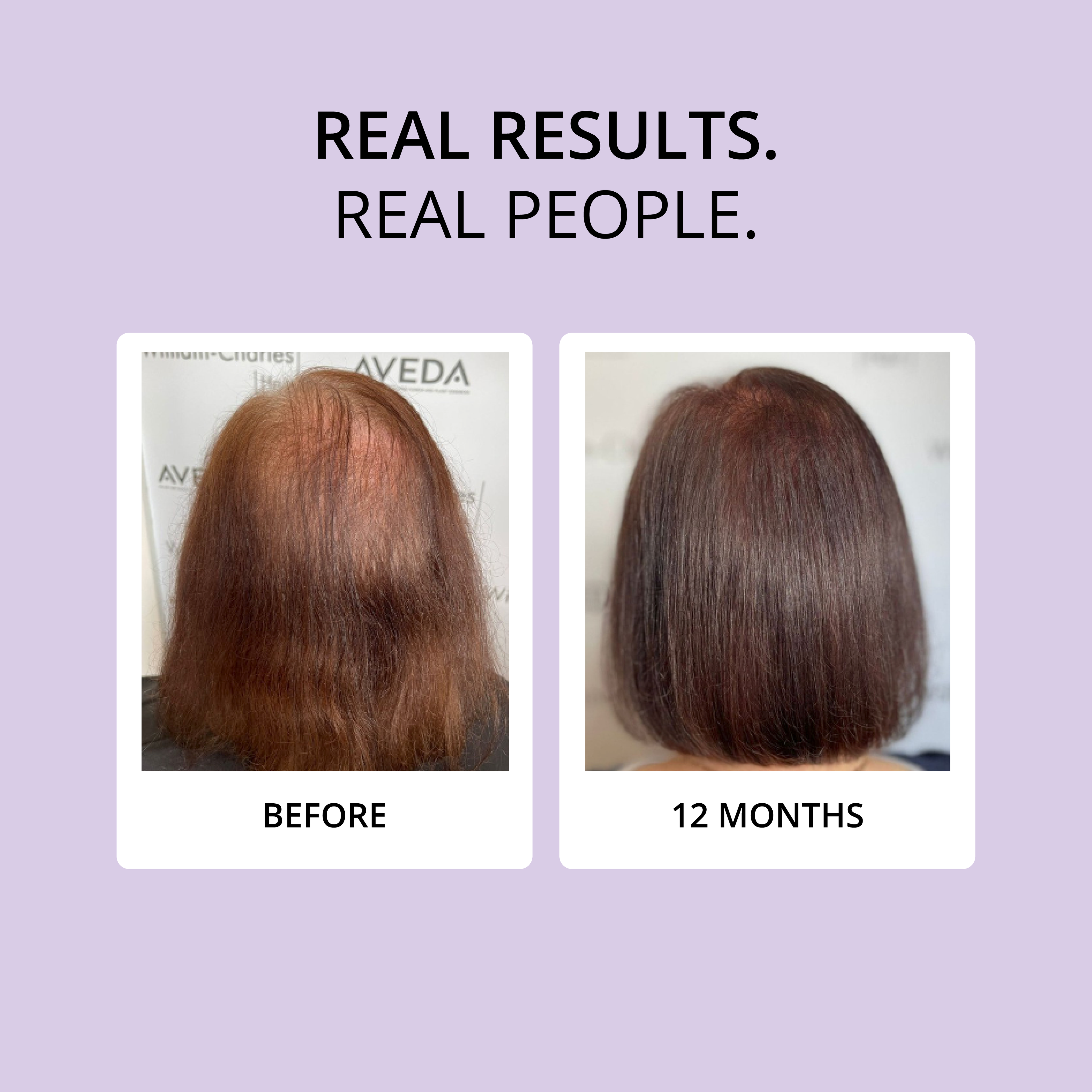 HAIR FOOD | MENO - 1 Month Supply