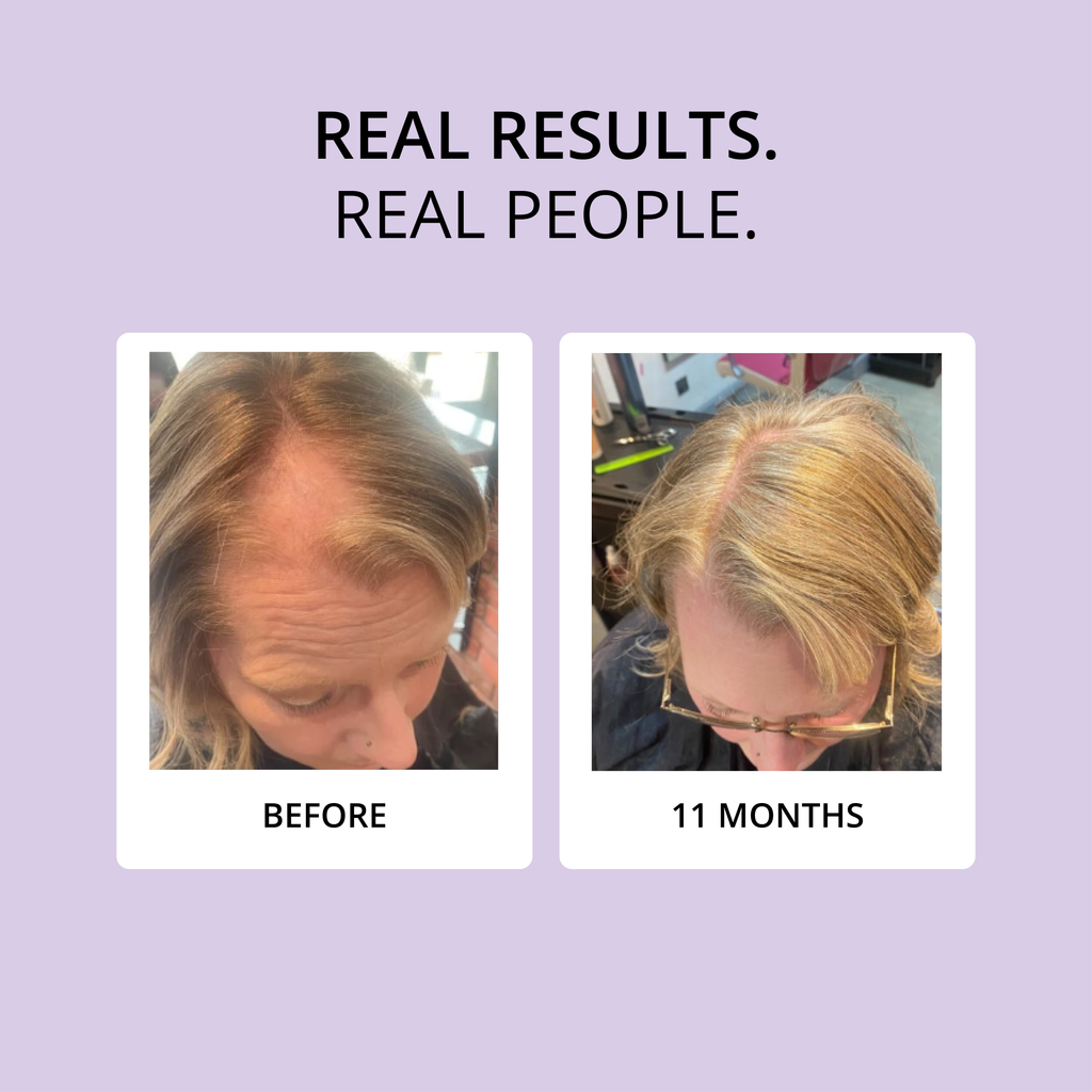 HAIR FOOD | MENO - 1 Month Supply