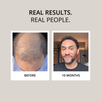 HAIR FOOD | MENS