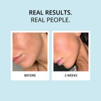 COLLAGEN CREAMER (15 DAY SUPPLY)