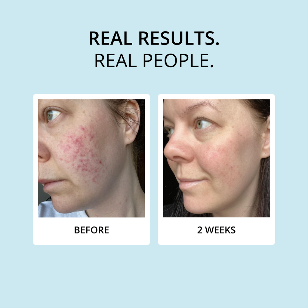 COLLAGEN CREAMER (15 DAY SUPPLY)