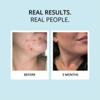 COLLAGEN CREAMER (15 DAY SUPPLY)