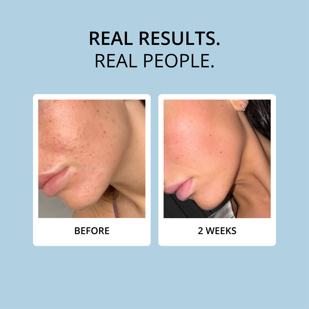 COLLAGEN - 15 DAY SUPPLY