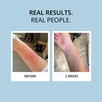 COLLAGEN - 15 DAY SUPPLY