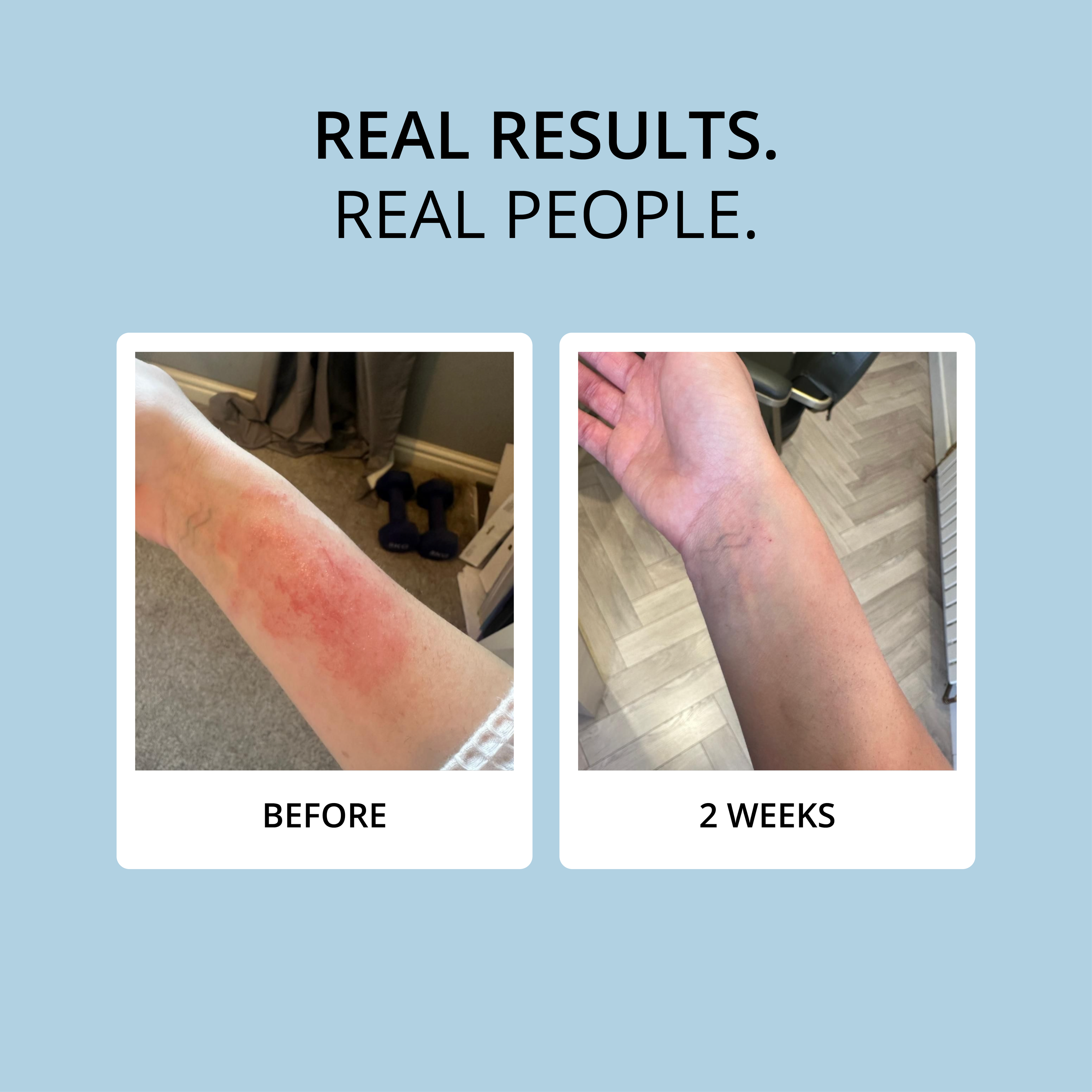 COLLAGEN - 15 DAY SUPPLY
