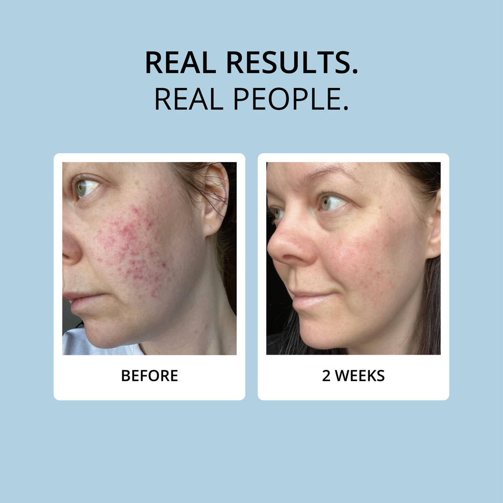 COLLAGEN - 15 DAY SUPPLY