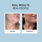 COLLAGEN - 15 DAY SUPPLY