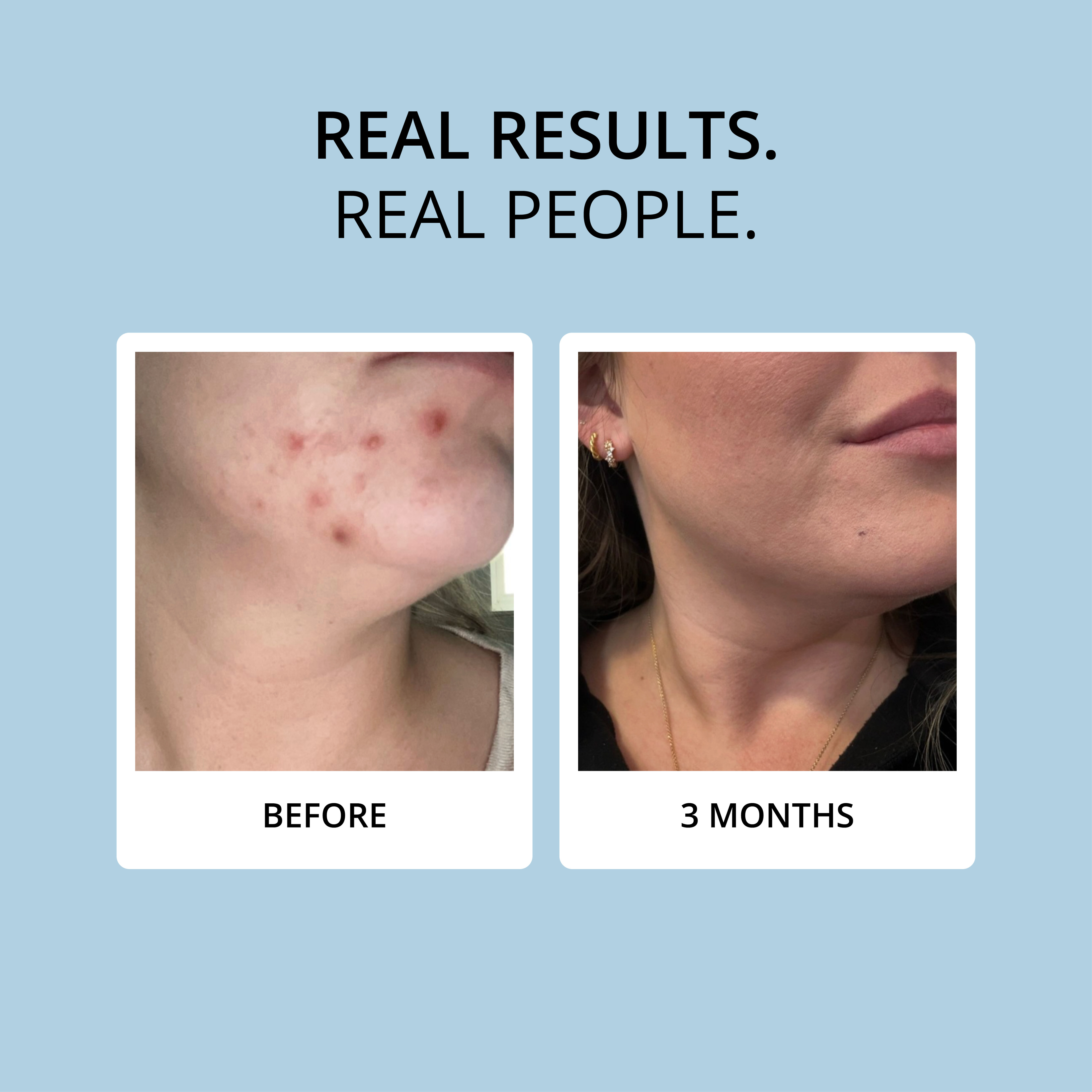 COLLAGEN - 15 DAY SUPPLY