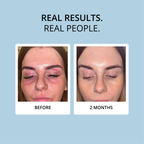 COLLAGEN - 15 DAY SUPPLY