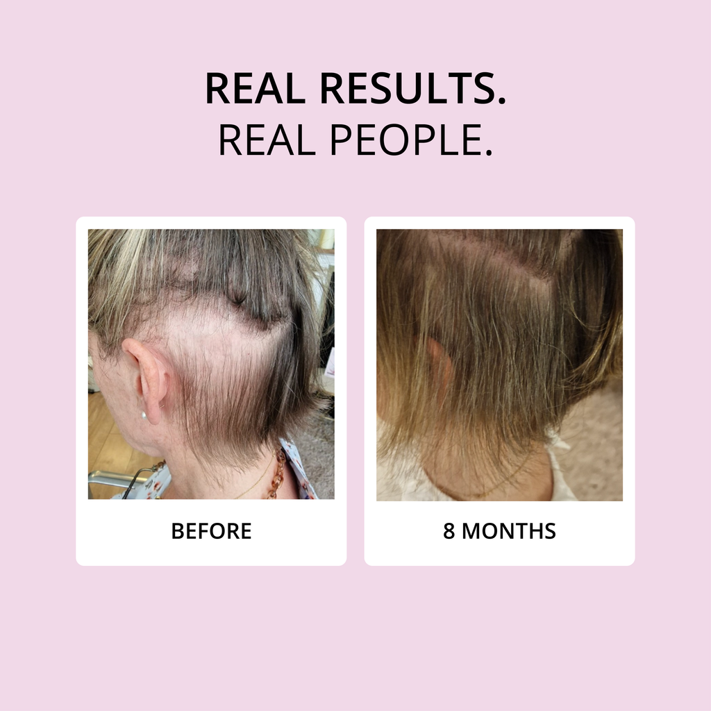 HAIR FOOD - Hair Vitamins, 1 Month Supply