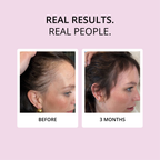 HAIR FOOD - Hair Vitamins, 1 Month Supply