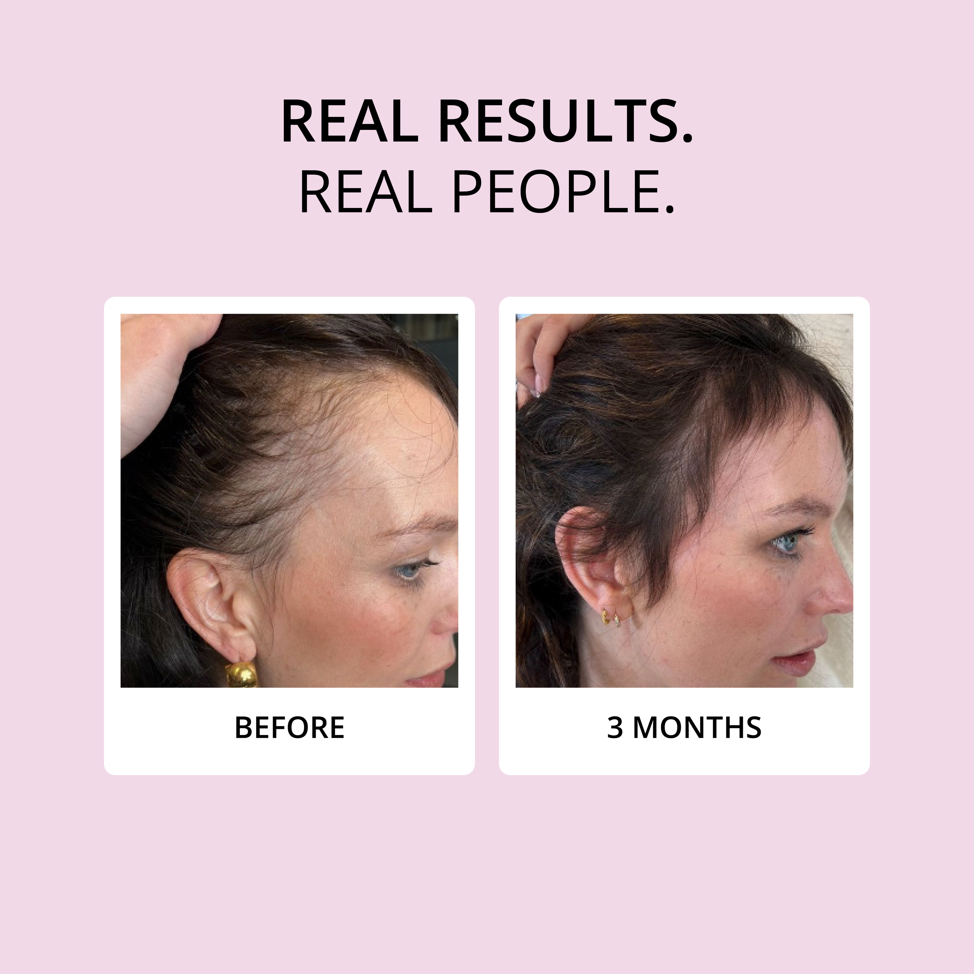 HAIR FOOD - Hair Vitamins, 1 Month Supply